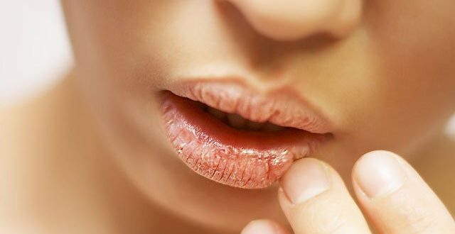 guby-trebuyut-uhoda-osobenno-zimoy