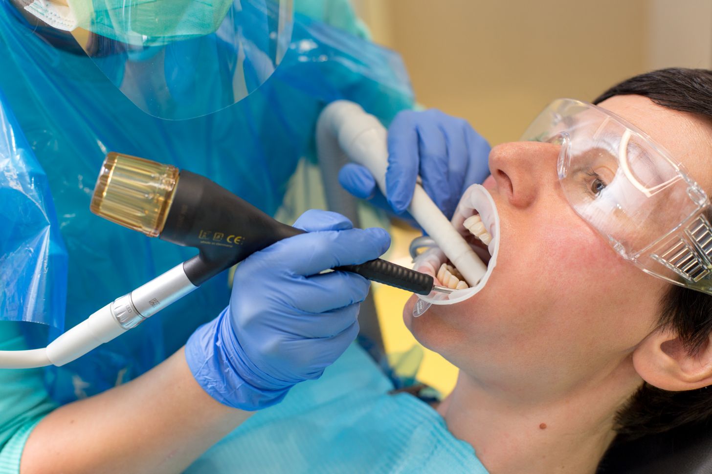 Как стоматологи делают чистку зубов. Профгигиена полости рта Air Flow. Профгигиена (ультразвук + Air-Flow). Ультразвук + Air Flow+фторирование.